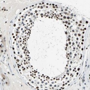 Anti-KAT6B antibody produced in rabbit 