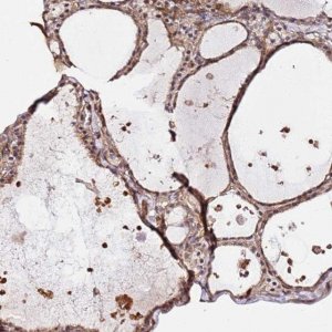 Anti-KATNAL2 antibody produced in rabbit 