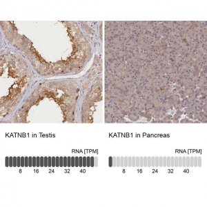 Anti-KATNB1 antibody produced in rabbit 