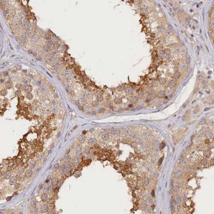 Anti-KATNB1 antibody produced in rabbit 