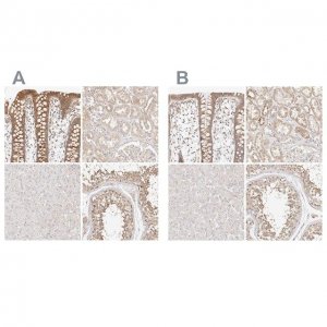 Anti-KCMF1 antibody produced in rabbit 