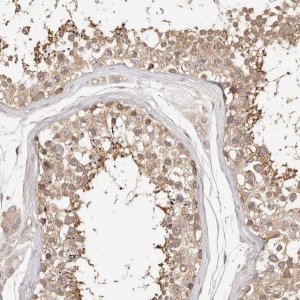 Anti-KCMF1 antibody produced in rabbit 