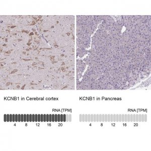 Anti-KCNB1 antibody produced in rabbit 