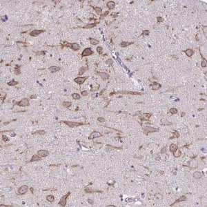 Anti-KCNB1 antibody produced in rabbit 