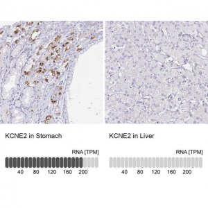Anti-KCNE2 antibody produced in rabbit 