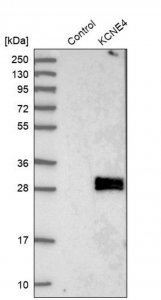 Anti-KCNE4 antibody produced in rabbit 