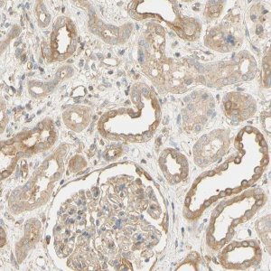 Anti-KCNE4 antibody produced in rabbit 