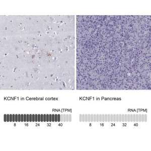 Anti-KCNF1 