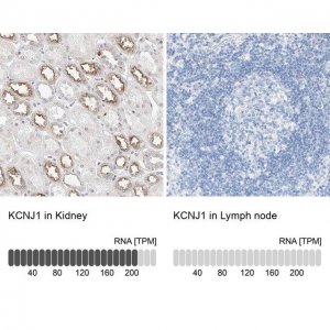 Anti-KCNJ1 antibody produced in rabbit 
