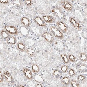Anti-KCNJ1 antibody produced in rabbit 