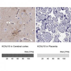Anti-KCNJ10 