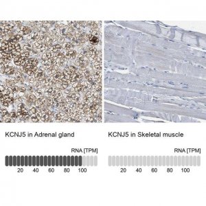 Anti-KCNJ5 antibody produced in rabbit HPA017353-100UL
