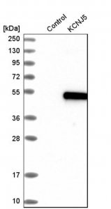 Anti-KCNJ5 antibody produced in rabbit HPA017353-100UL