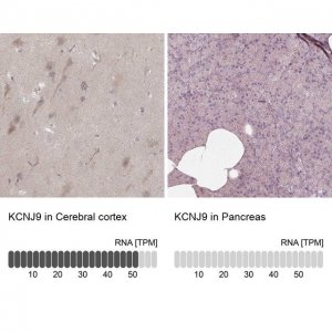 Anti-KCNJ9 antibody produced in rabbit 