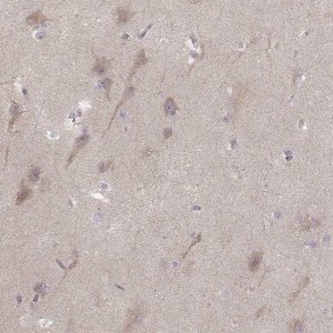 Anti-KCNJ9 antibody produced in rabbit 