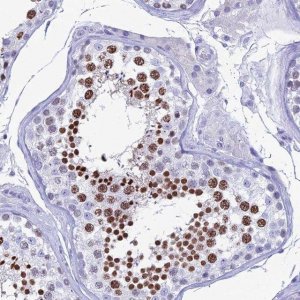 Anti-KCNK17 antibody produced in rabbit HPA043892-100UL