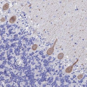 Anti-KCNK18 antibody produced in rabbit 