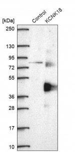 Anti-KCNK18 antibody produced in rabbit 