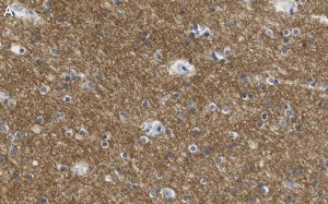 Anti-KCNQ2 Antibody, clone 2G18 ZooMAb Rabbit Monoclonal 