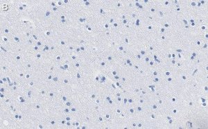 Anti-KCNQ2 Antibody, clone 2G18 ZooMAb Rabbit Monoclonal 