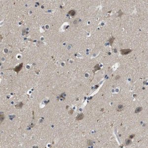 Anti-KCNQ5 antibody produced in rabbit 