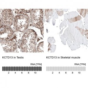 Anti-KCTD13 antibody produced in rabbit 