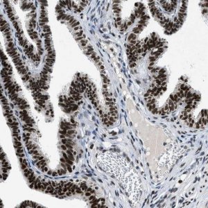 Anti-KDM3B antibody produced in rabbit 