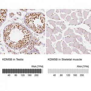 Anti-KDM5B antibody produced in rabbit 