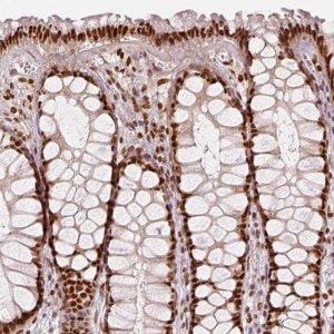 Anti-KDM5B antibody produced in rabbit 