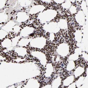 ANTI-KDM6A antibody produced in rabbit 