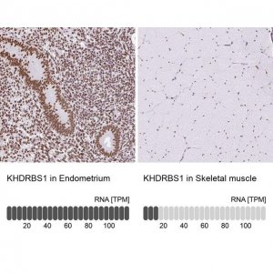 Anti-KHDRBS1 antibody produced in rabbit 
