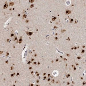 Anti-KHDRBS2 antibody produced in rabbit 