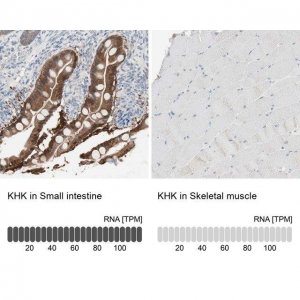Anti-KHK antibody produced in rabbit HPA007040-100UL