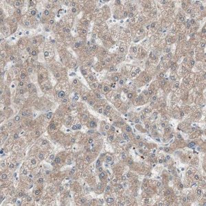 Anti-KHK antibody produced in rabbit HPA007040-100UL