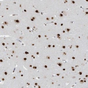 Anti-KHSRP antibody produced in rabbit 