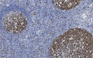 Anti-Ki67 Antibody, clone 1O15, ZooMAb Rabbit Monoclonal 