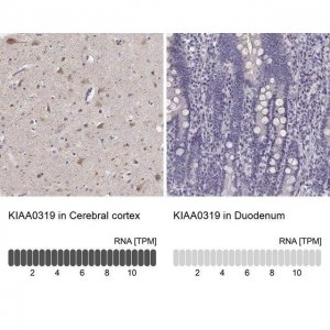 Anti-KIAA0319 antibody produced in rabbit 