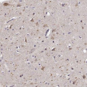 Anti-KIAA0319 antibody produced in rabbit 