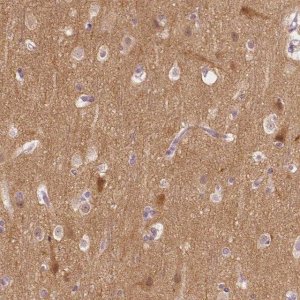 Anti-KIAA0513 antibody produced in rabbit HPA014431-100UL