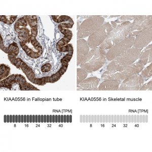 Anti-KIAA0556 antibody produced in rabbit 