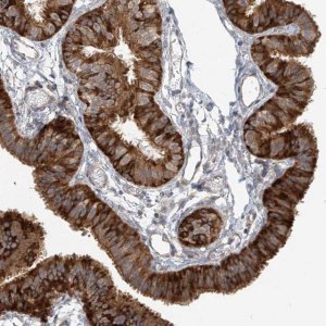 Anti-KIAA0556 antibody produced in rabbit 