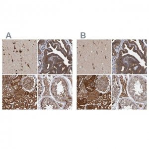 Anti-KIAA0753 antibody produced in rabbit 