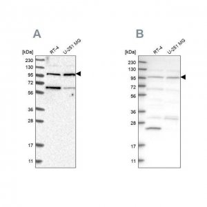 Anti-KIAA0753 antibody produced in rabbit 