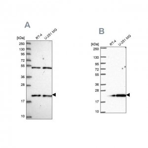 Anti-KIAA1143 antibody produced in rabbit 