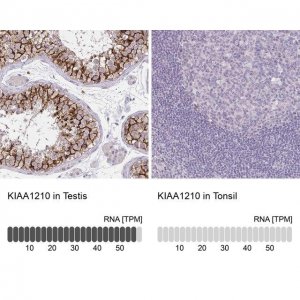 Anti-KIAA1210 antibody produced in rabbit 