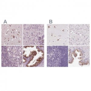 Anti-KIAA1324 antibody produced in rabbit 