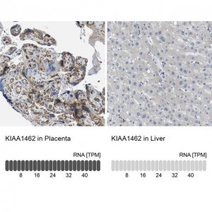 Anti-KIAA1462 antibody produced in rabbit 