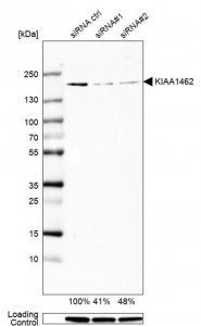 Anti-KIAA1462 antibody produced in rabbit 