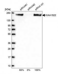 Anti-KIAA1522 antibody produced in rabbit 