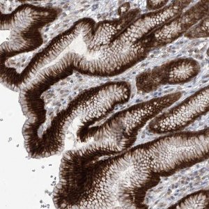 Anti-KIAA1522 antibody produced in rabbit 